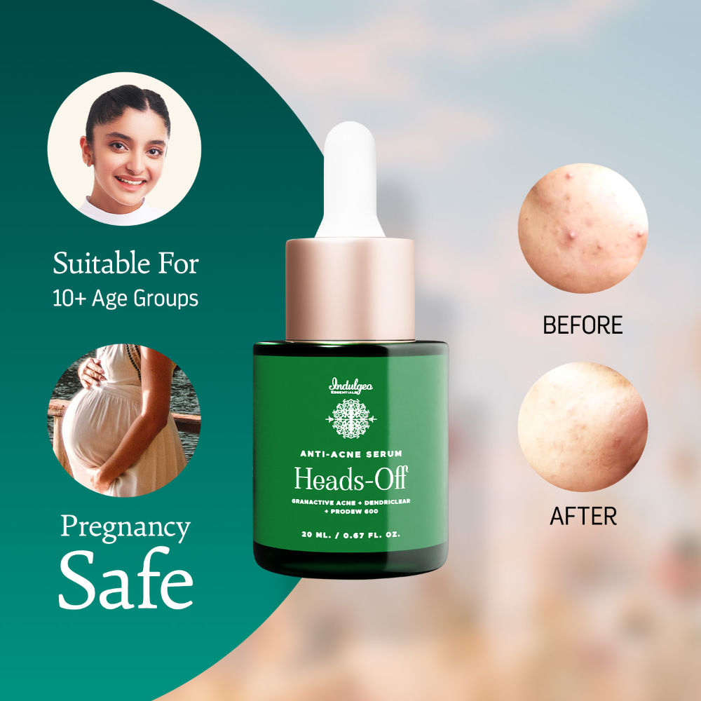 Heads Off Anti Acne Face Serum