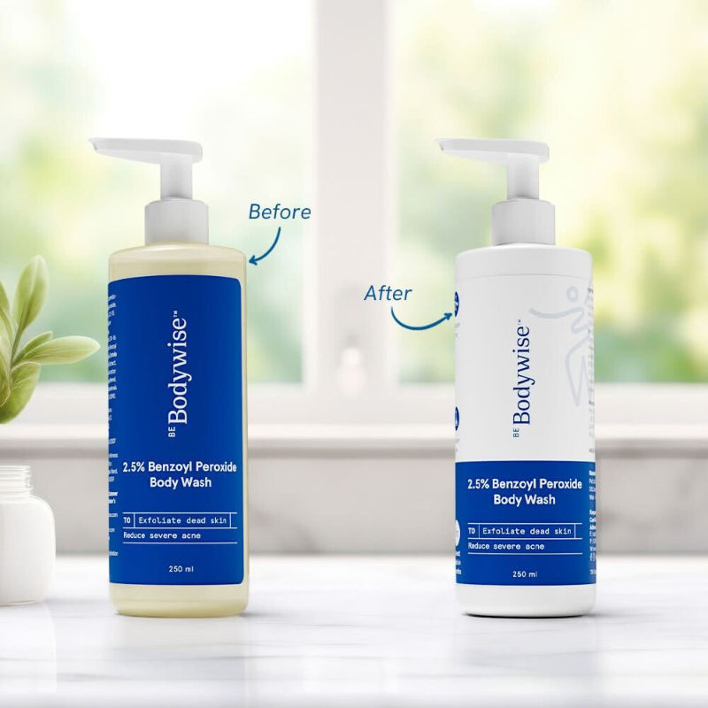 2.5% Benzoyl Peroxide Body Wash Treats Stubborn Back Acne