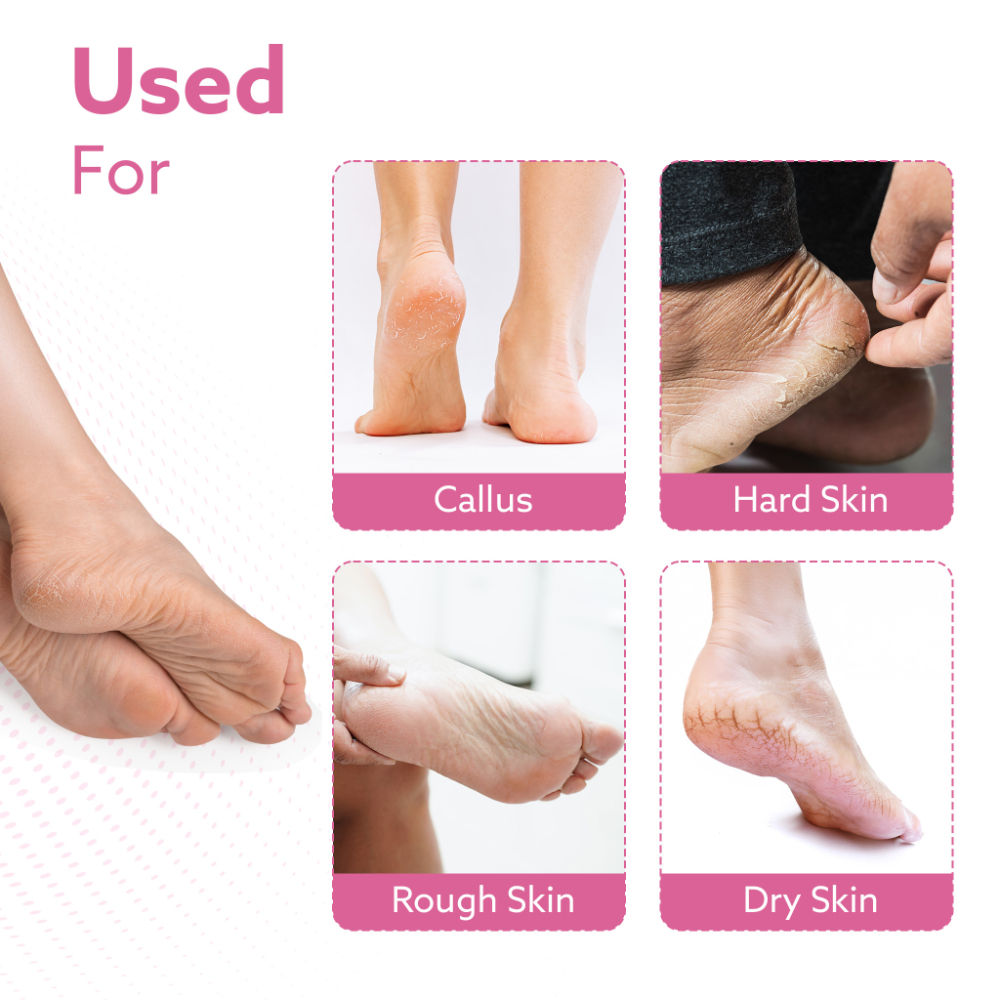 CR1717 Callus Remover Refill Head