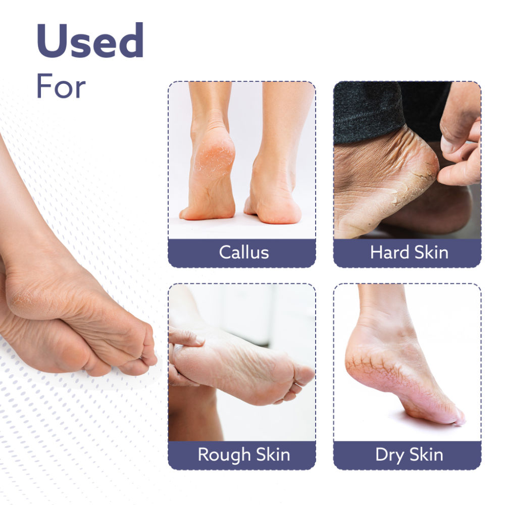 CR1414 Callus Remover Refill Head