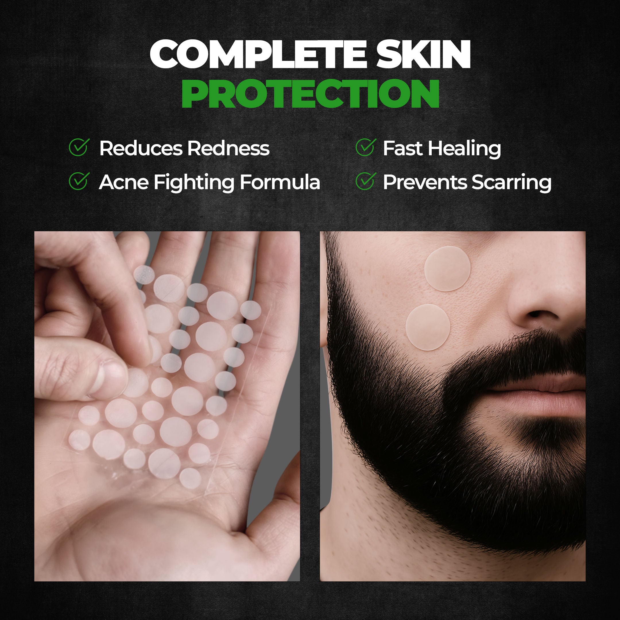 Acne Pimple Patch