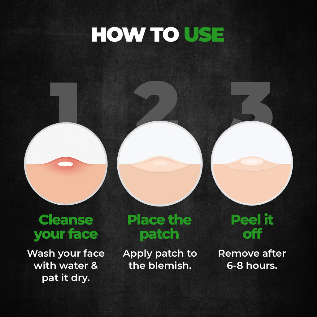 Acne Pimple Patch