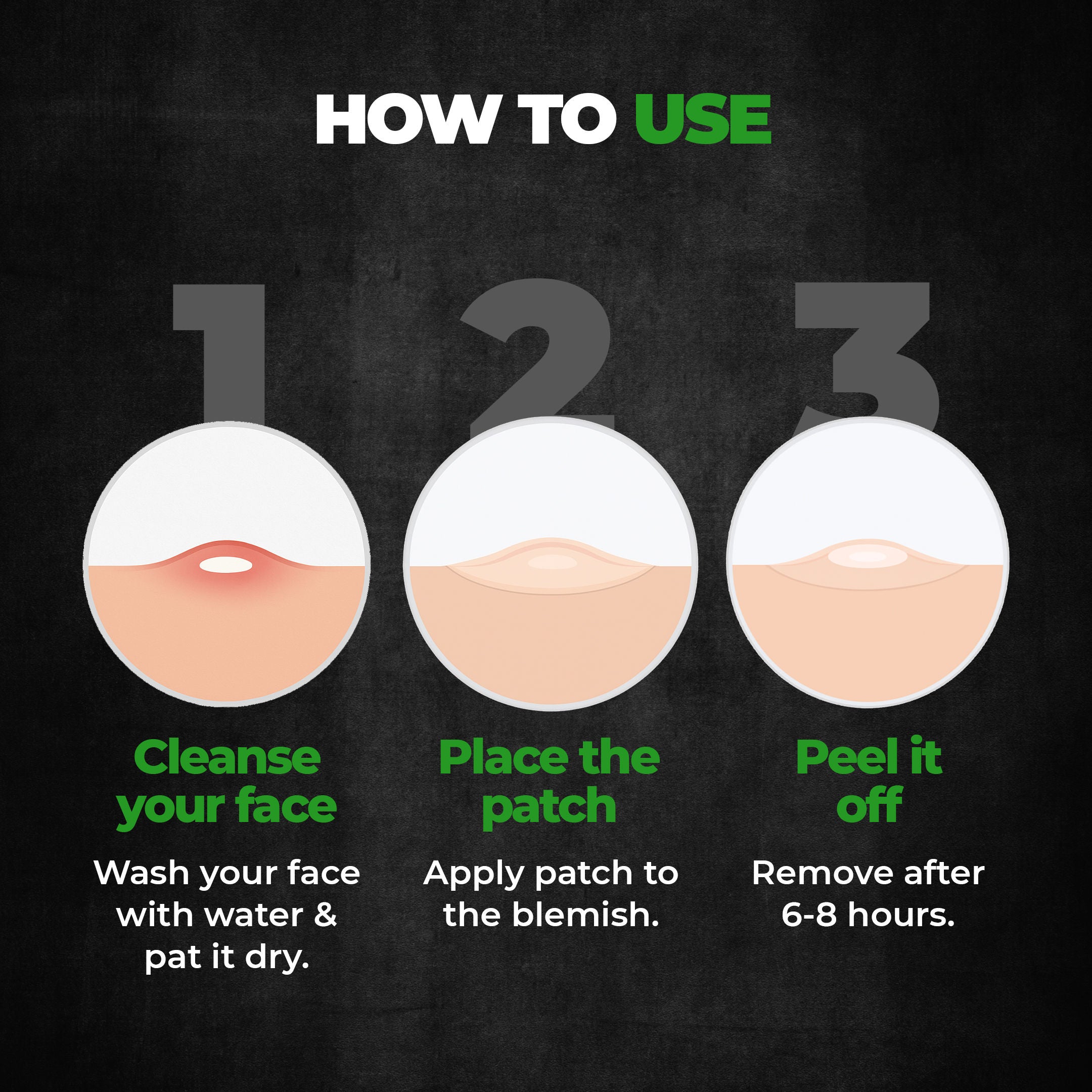 Acne Pimple Patch