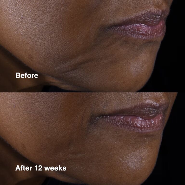 Smart Clinical Repair Lifting Face + Neck Cream