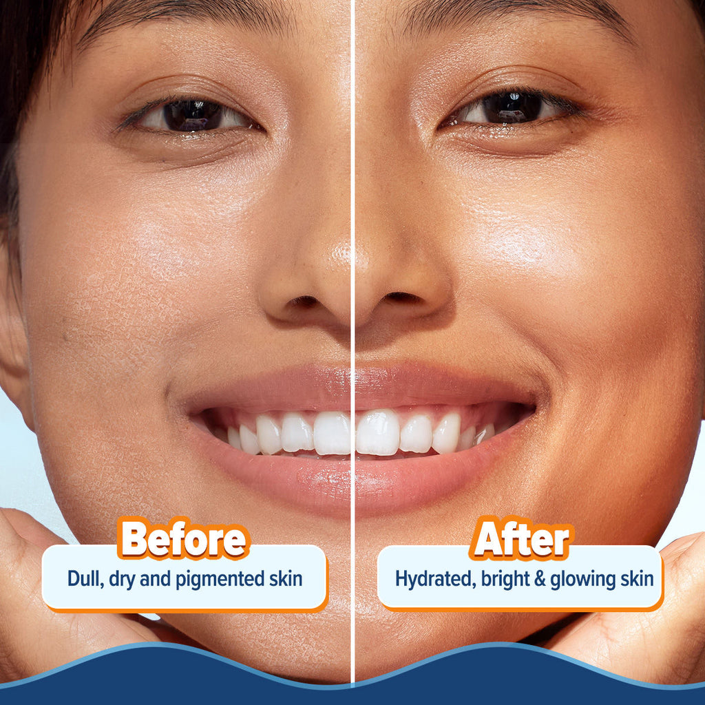 Glow+ Hydra Gel Moisturizer With Papaya & Vitamin C For 24 Hour Intense Hydration