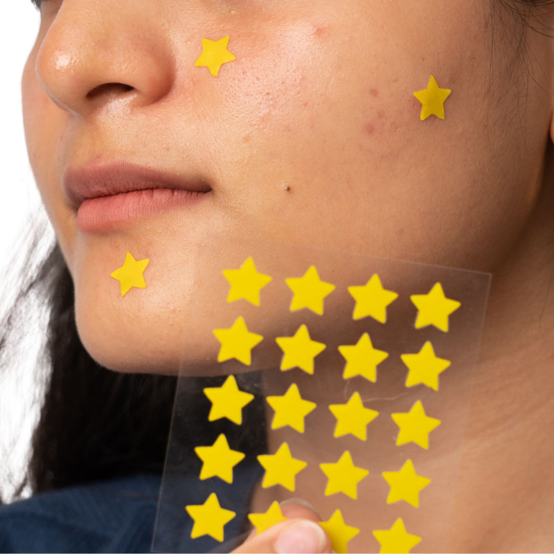 Dart It Pimple Patches Work in 6-8 Hrs For Acne, Zits And Blemishes - Super Star