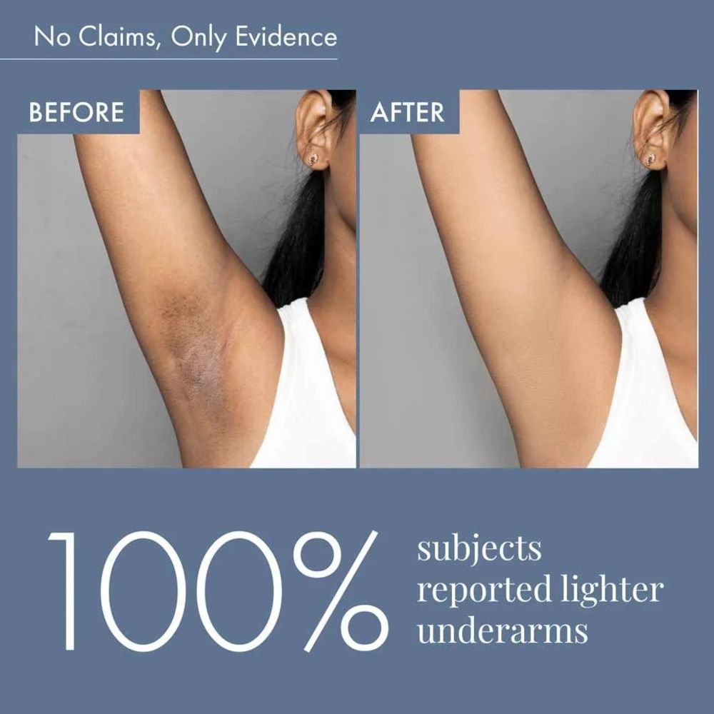 Aqua Bleu Underarm Brightening Roll-On