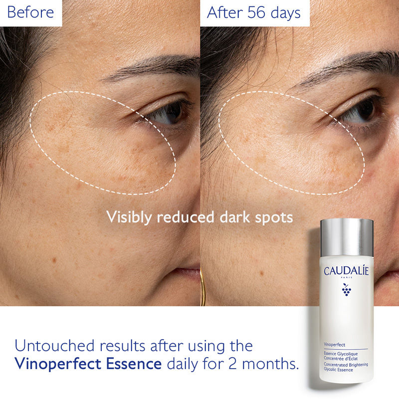 Vinoperfect Concentrated Brightening Glycolic Essence (Toner)