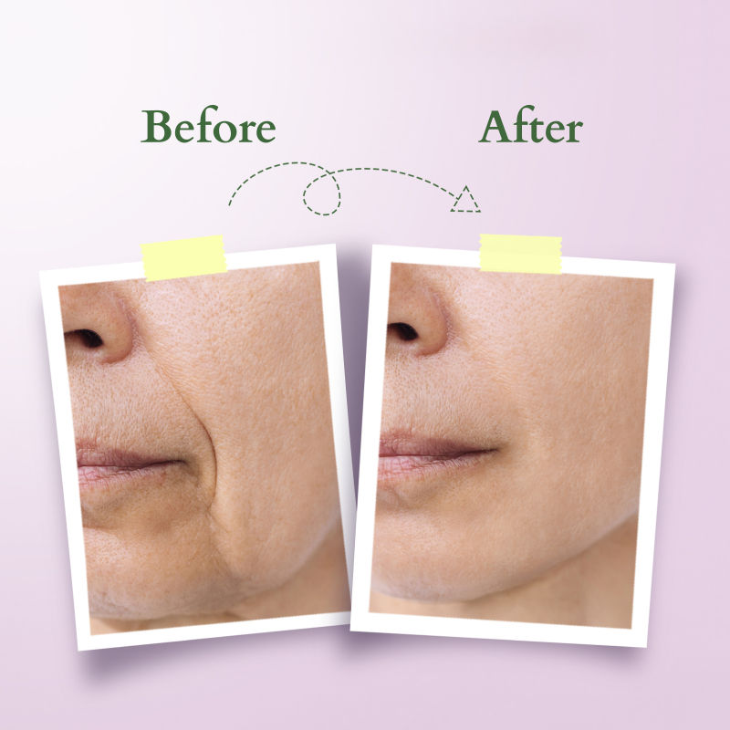 Lotus Organics+ Bakuchiol Plant Retinol Super Serum