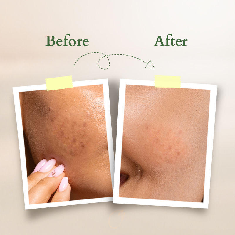 Vit-C Radiance Booster Cleanser - Lemon Verbena