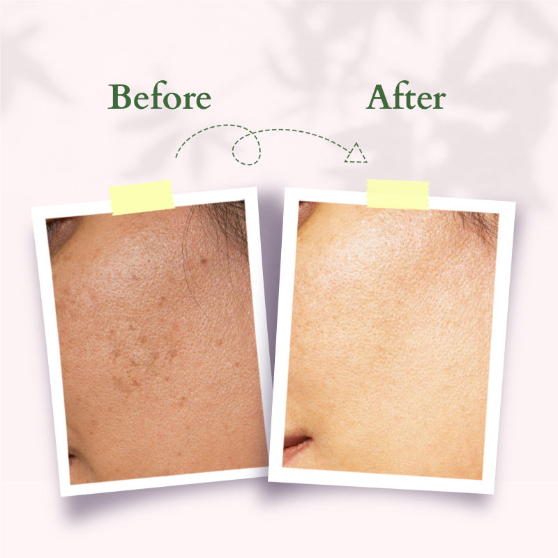 Lotus Organics Precious Brightening Face Exfoliator, White Peony,Gentle,Effective Organic Face Scrub