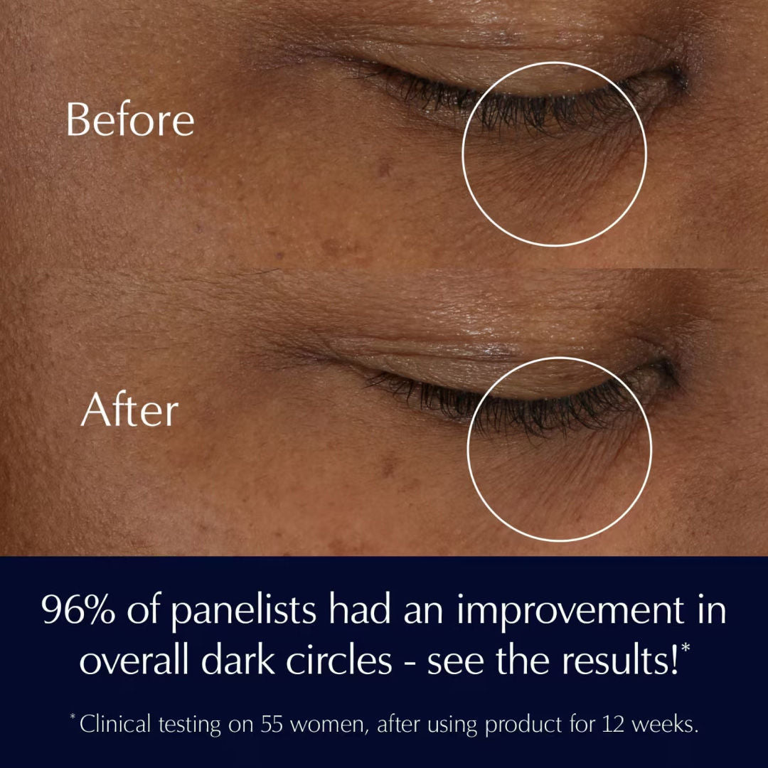 Advanced Night Repair Eye Supercharged Gel Creme With Hyaluronic Acid (Under Eye Care)