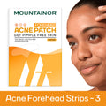 Forehead Acne Pimple Patch Strips, Salicylic Acid Spot Corrector, Blackhead & Whitehead