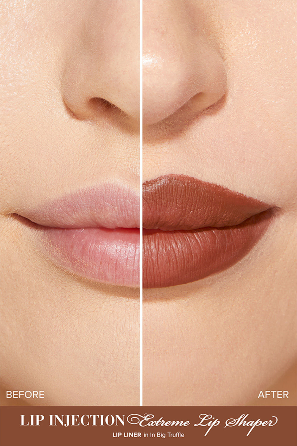 Lip Injection Extreme Lip Shaper