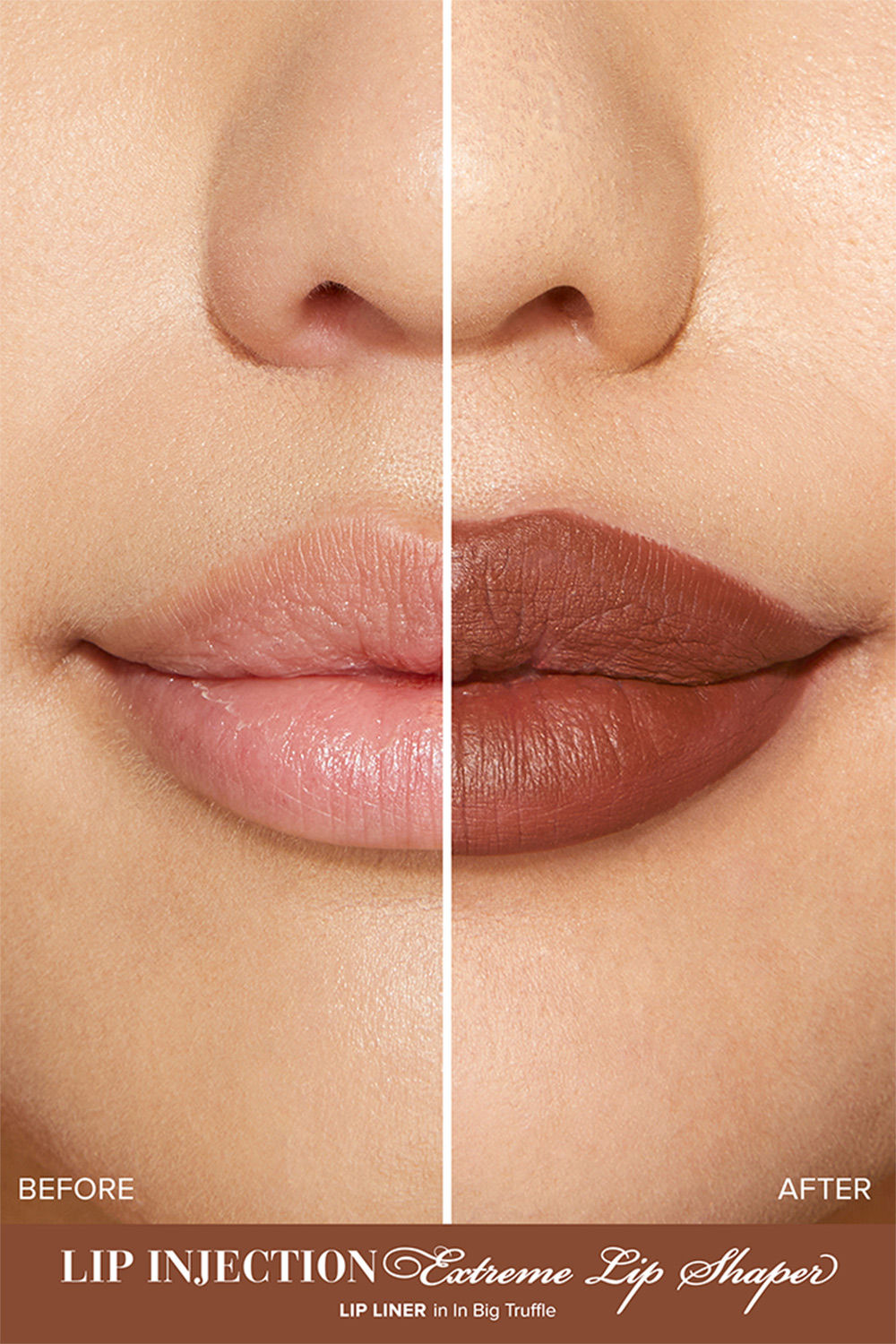 Lip Injection Extreme Lip Shaper