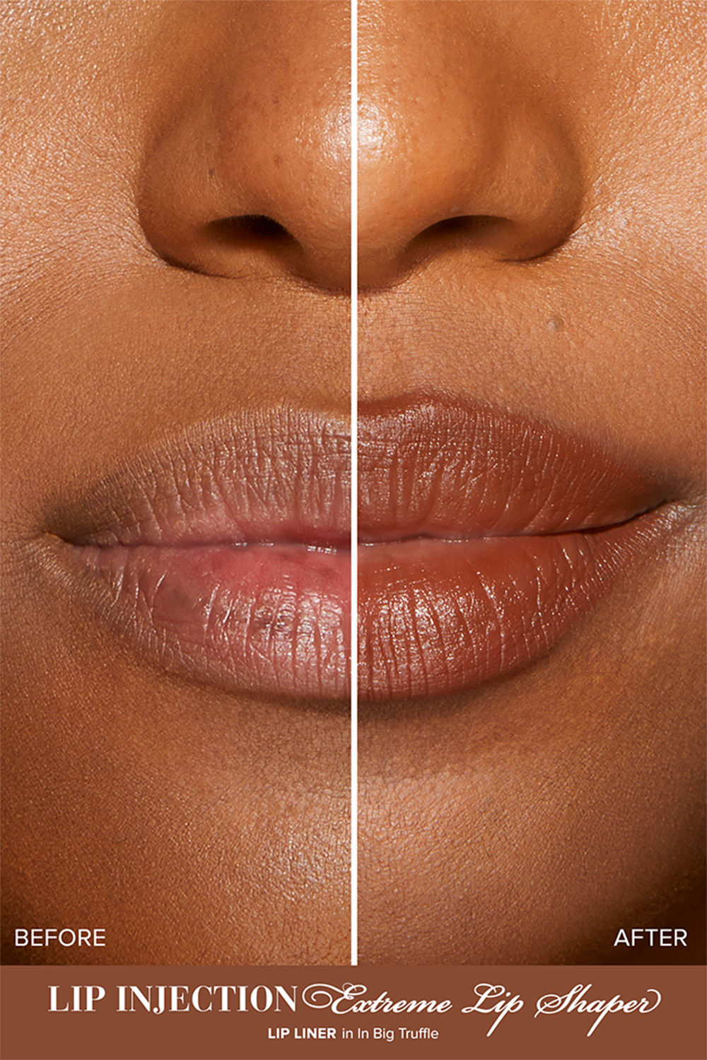 Lip Injection Extreme Lip Shaper