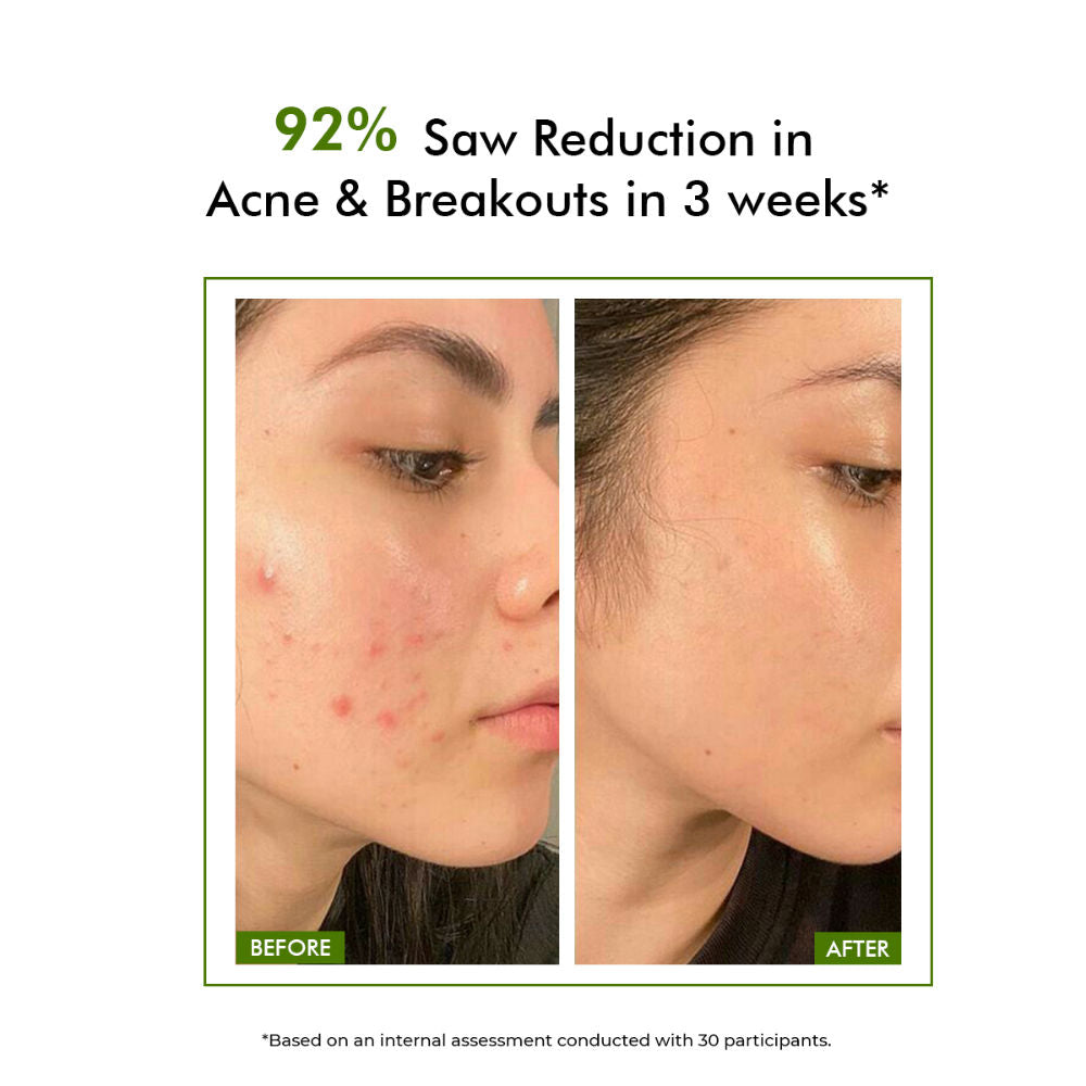 Salicylic Acid Face Wash For Oily Acne Prone Skin With Glycolic Acid &CICA Extract