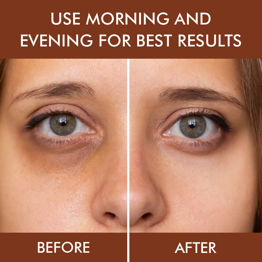 Under Eye Gel for Dark Circles Removal