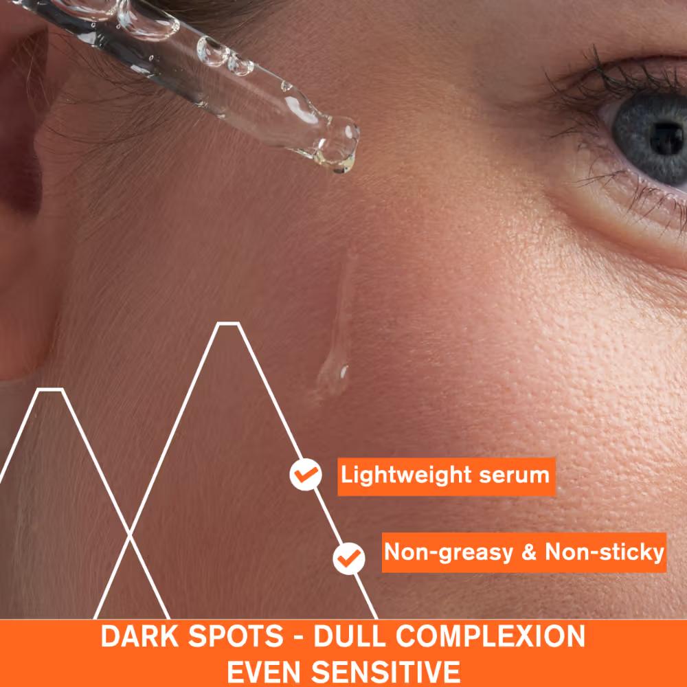 Depiderm 20% Vitamin C Anti-Dark Spot Serum Reduces Hyperpigmentation, Melasma & Dark Spots