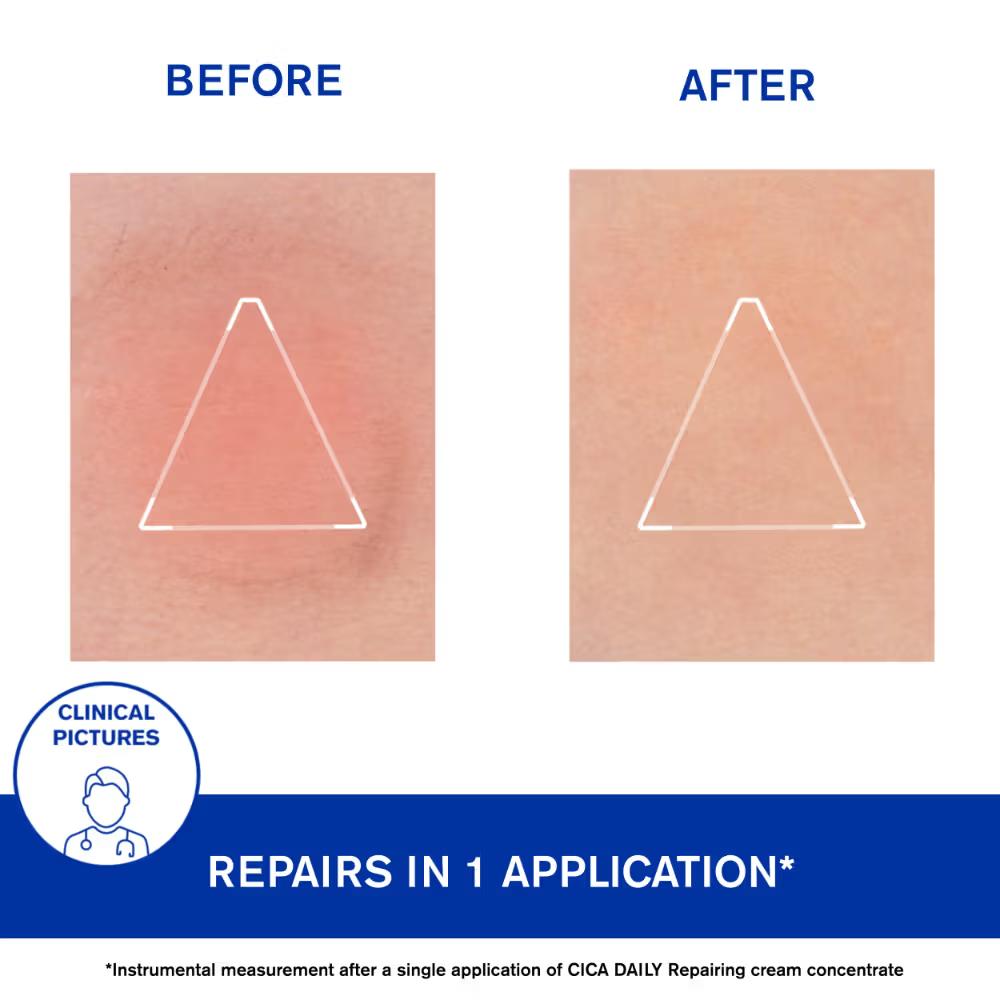 Cica-Daily Intense Repairing Anti-Pollution Serum 10.5% Thermal Biotic Complex Repairs Skin