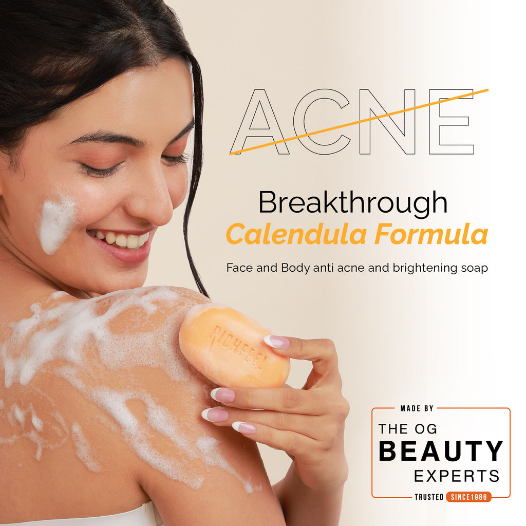 Calendula Anti-Acne Soap: Fights Pimples, Blemishes & Promotes Healthy, Luminous Skin