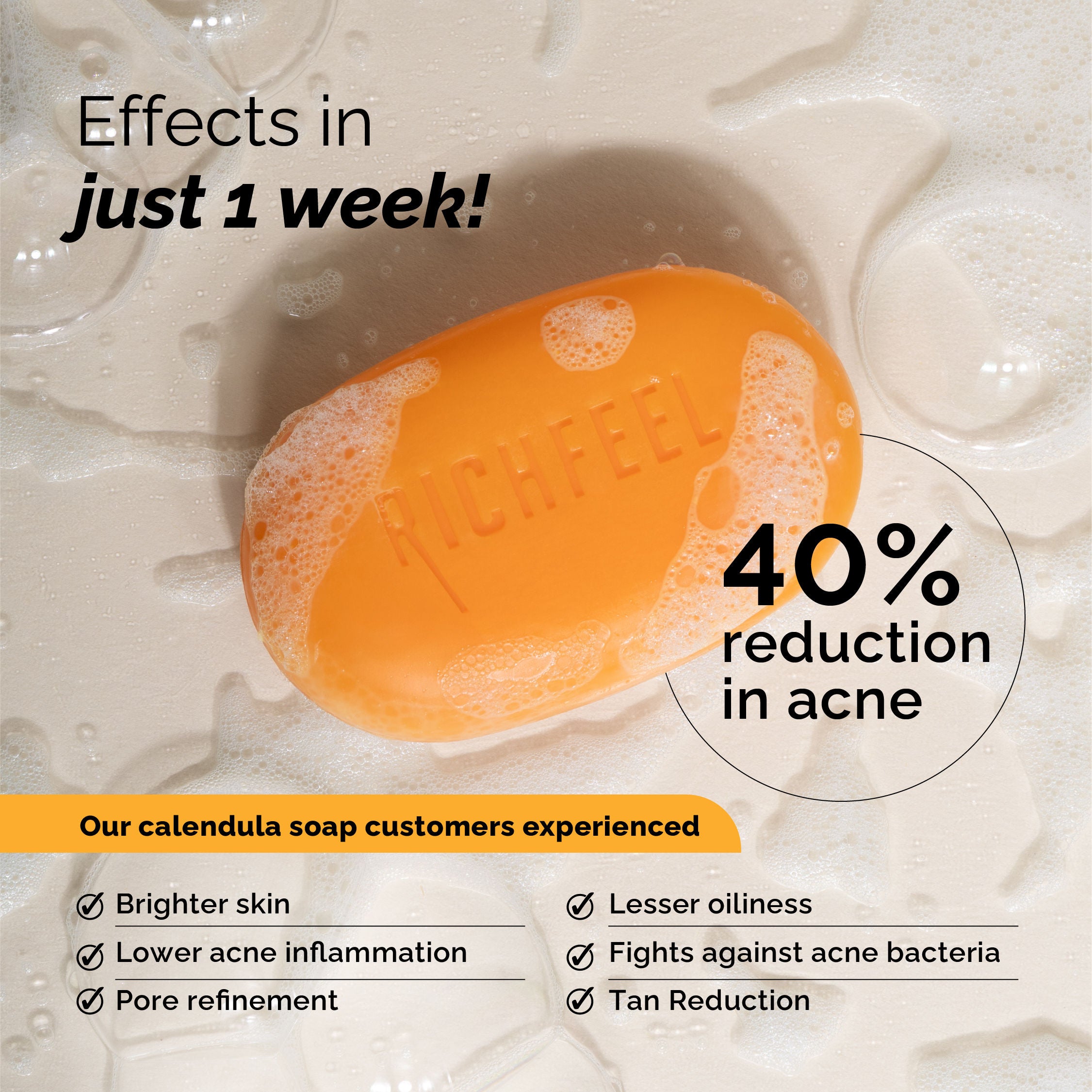 Calendula Anti-Acne Soap: Fights Pimples, Blemishes & Promotes Healthy, Luminous Skin