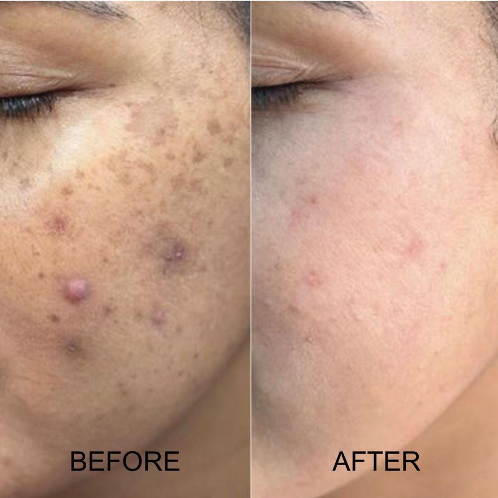 Skin Lightening Lotion - Reduces Pigmentation, Lightens Spots & Tan, Non-Oily Base