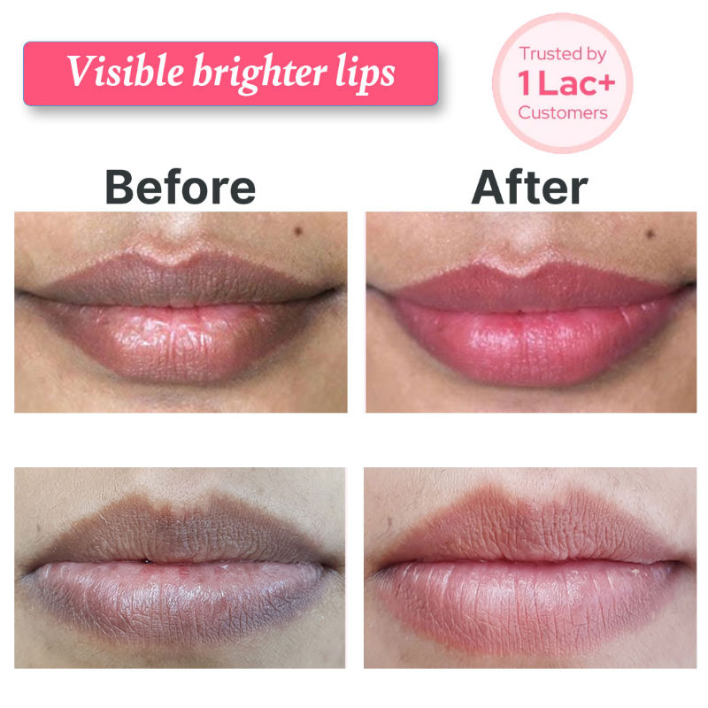 Lip Wash Lip Brightening, Lip Cleanser, For Dark & Dry Pigmented Lips For Women
