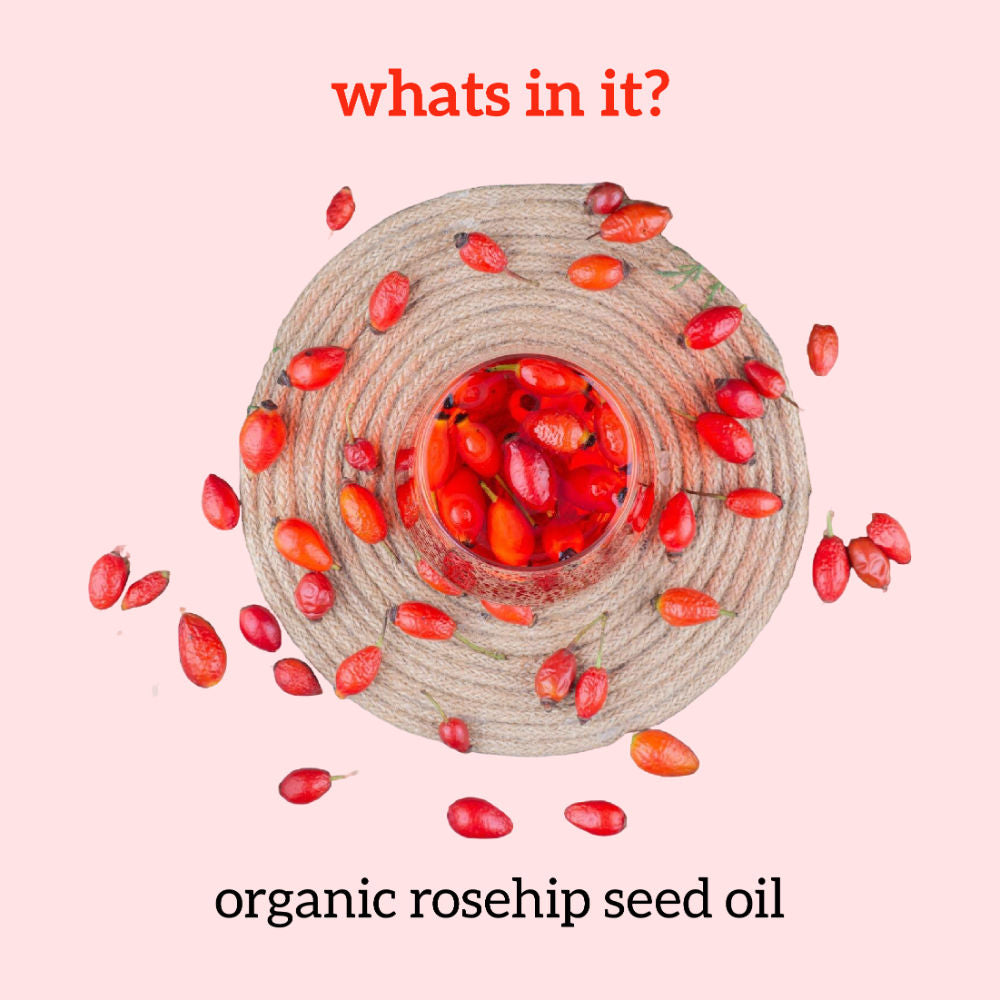 Rosehip Oil, 100% Pure & Cold Pressed, Moisturizing, Anti-Aging & Hydrating Facial Oil