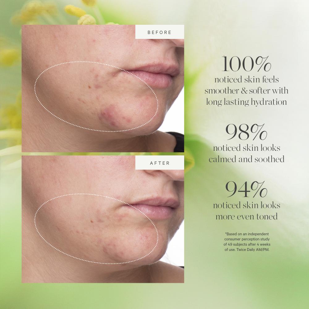 Active Algae Moisturizer- Reduces Dullness Fine Lines Pores With Green Algae Green Tea