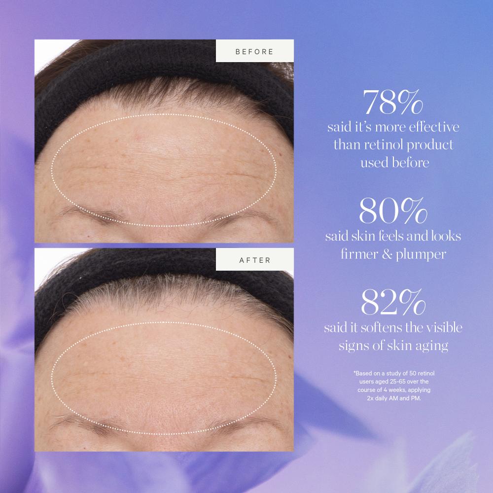 Plant Stem Cell Retinol Alternative Serum Firms Smooths Protect With Bakuchiol Rosehip