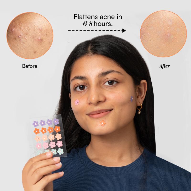 Dart It Hydrocolloid Pimple Patches - Transparent