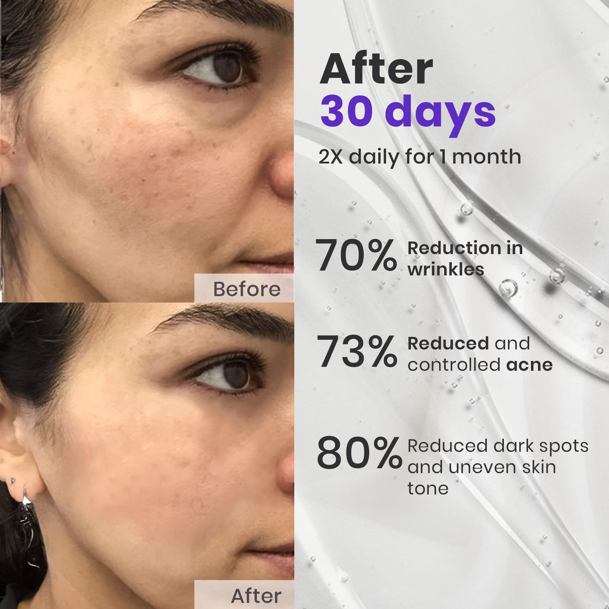 Anti Ageing Serum