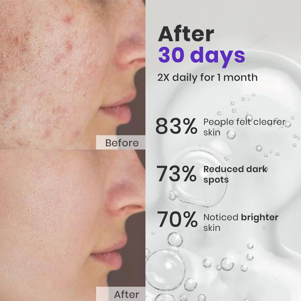 Face Spot Corrector
