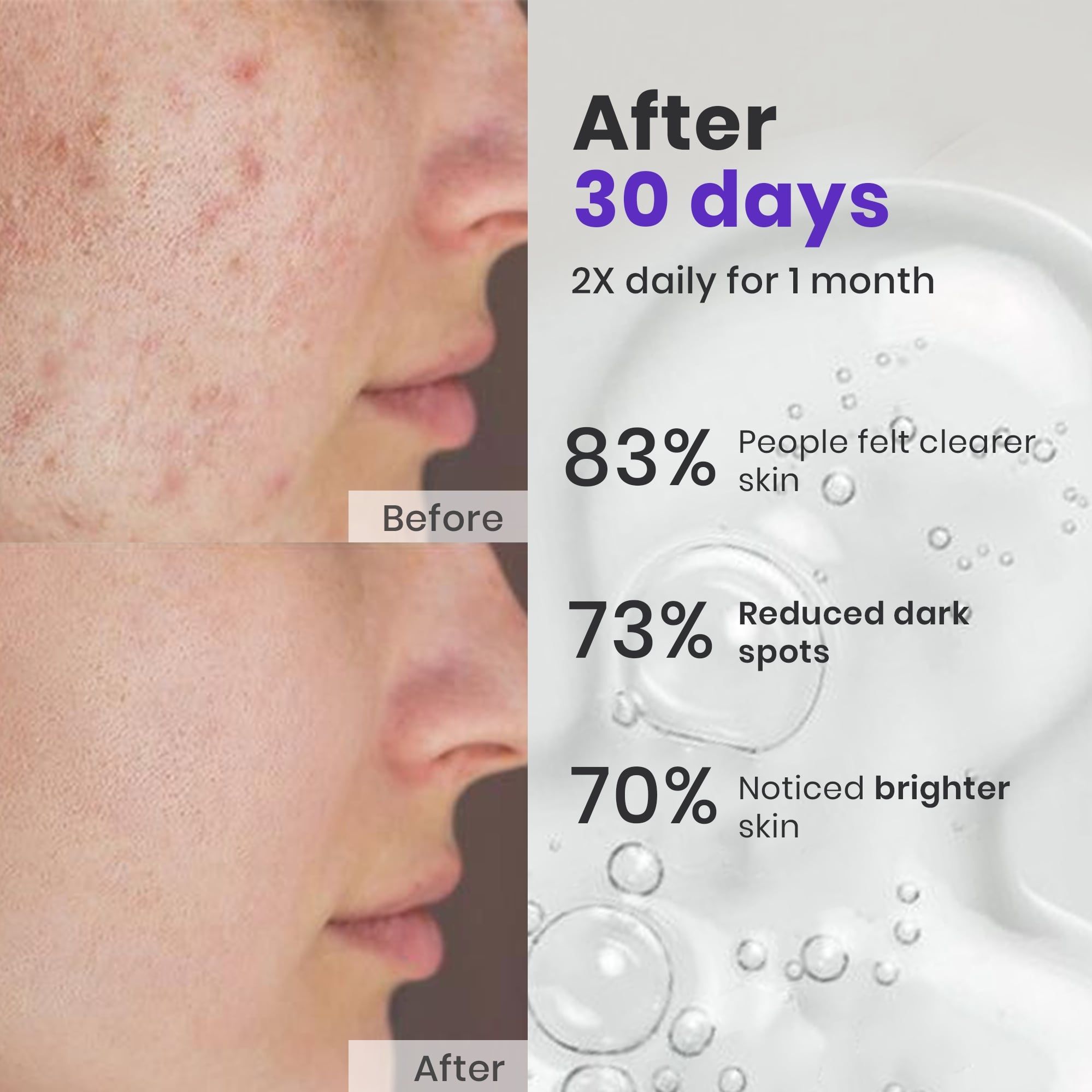 Face Spot Corrector