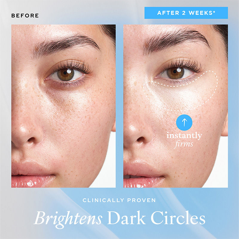 Aqua Bomb Korean Under Eye Cream-Vegan gel,for dark circles with Hyaluronic Acid & Niacinamide