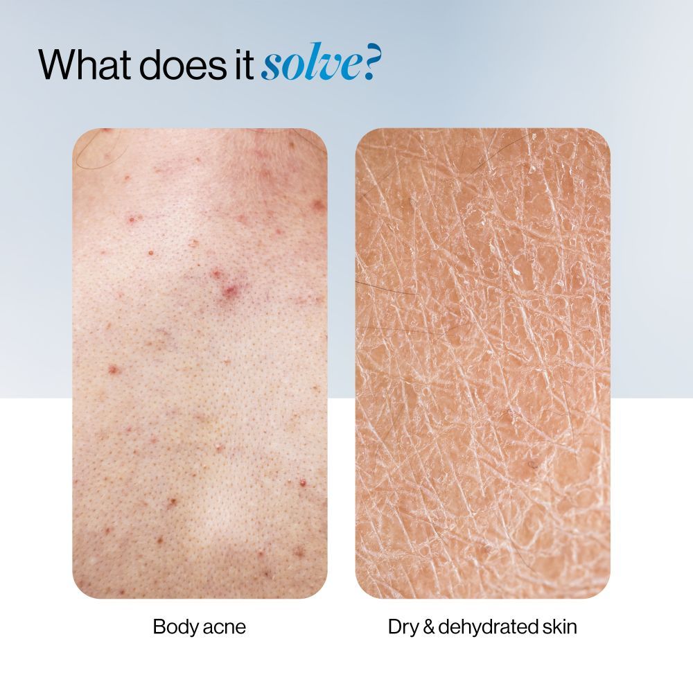 1% Salicylic Ceramide Body Wash - Dual Pump 2in1 Body Wash - For Body Acne and Dry Skin