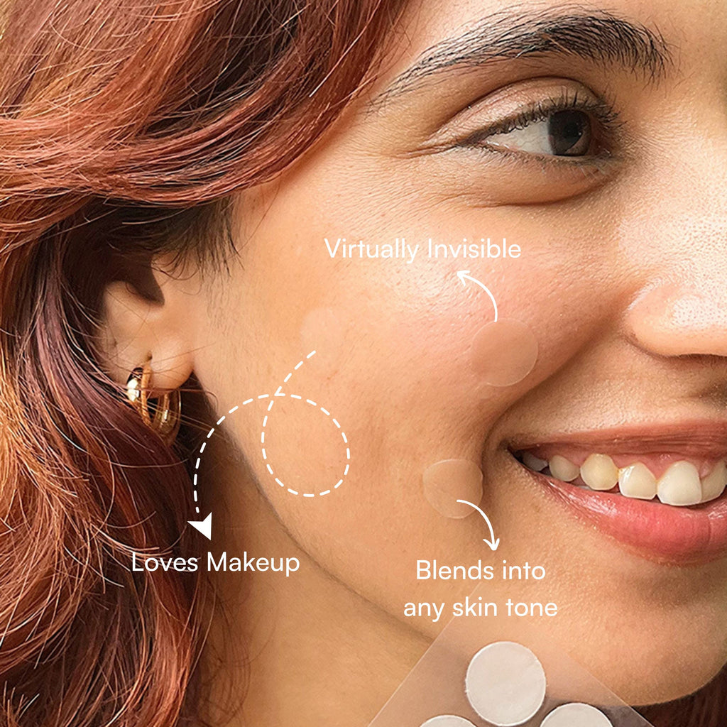Dart It Hydrocolloid Pimple Patches