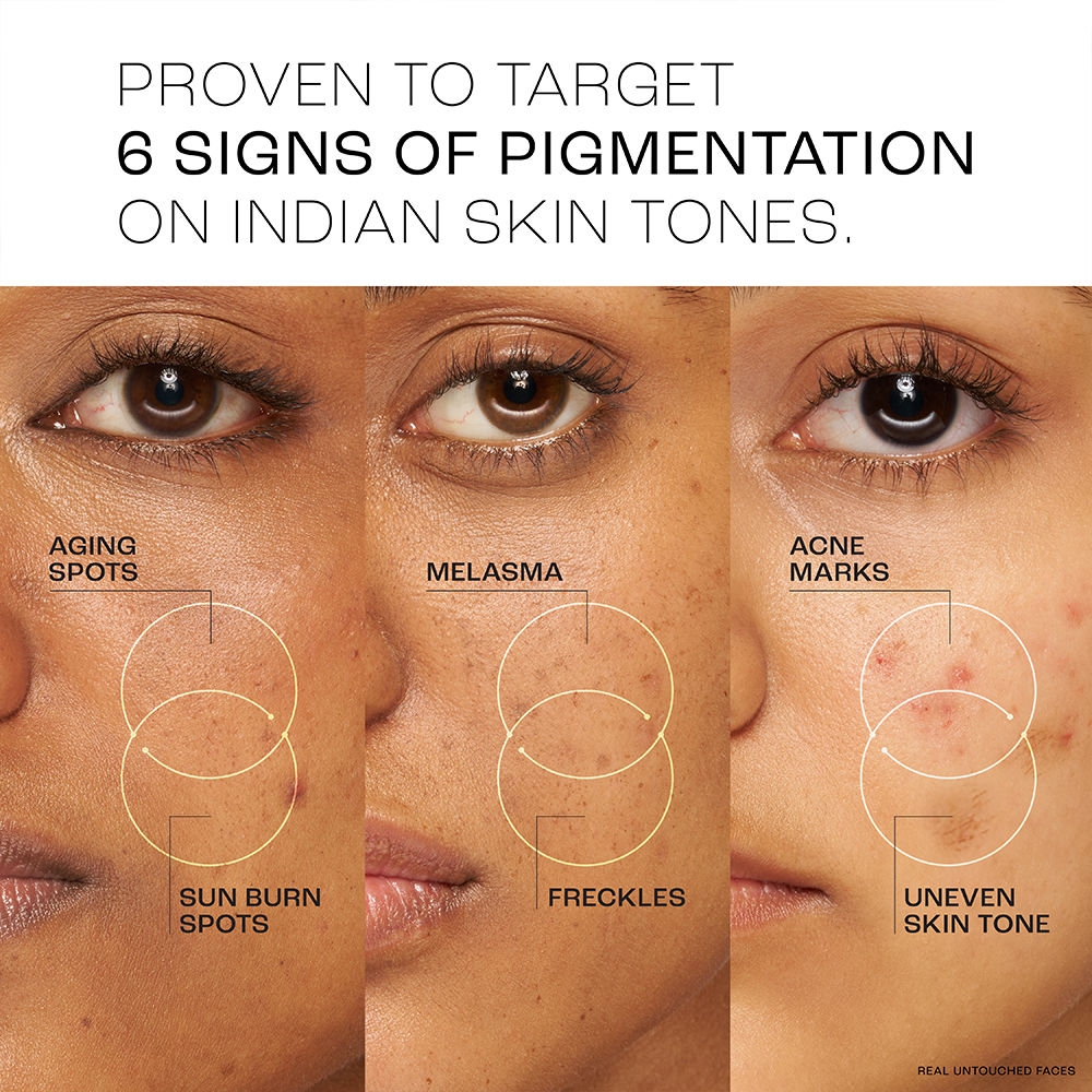 Absolute Perfect Radiance Serum With 7% Pure Niacinamide For 2X Skin Brightening