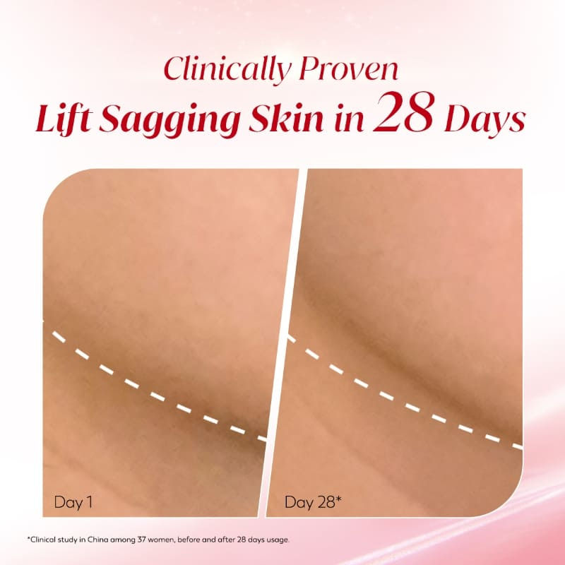 Super Collagen Peptides Moisturizer For Firm & Lifted Skin, Reduces 5 Signs Of Ageing