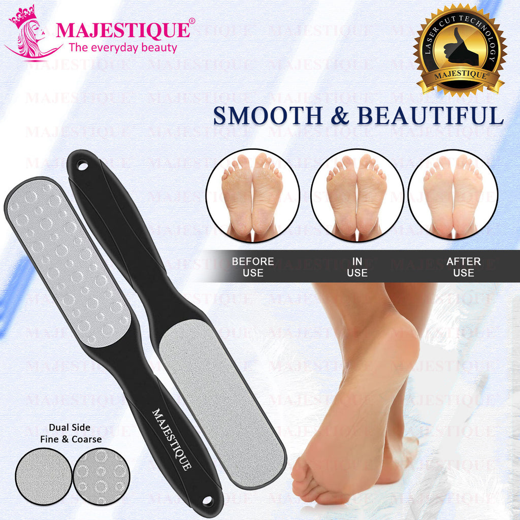 Callus Remover Foot Scrubber for Pedicure Spa Treatment - Color May Vary