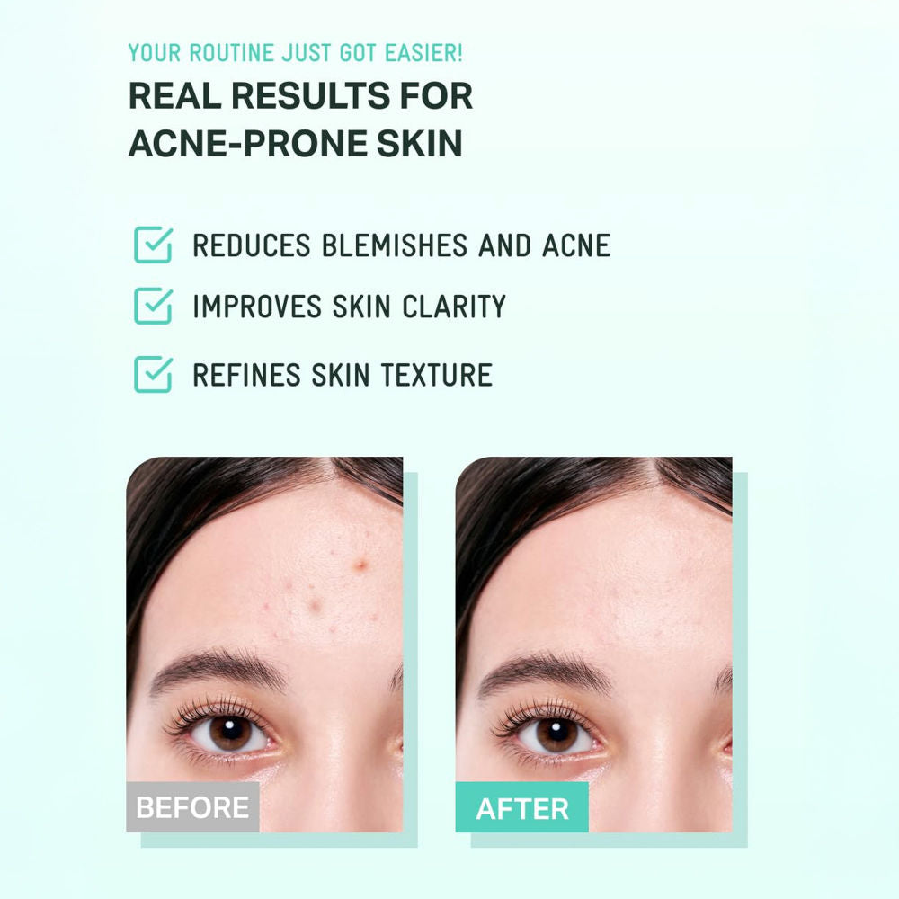 Tea Tree Cica Soothing Cream Plus, Hydrating Korean Centella Moisturizer