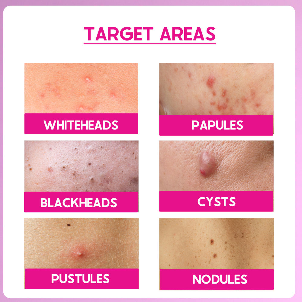 Peel ABP-11% Exfoliate AHA + BHA + PHA Beginner Friendly Serum