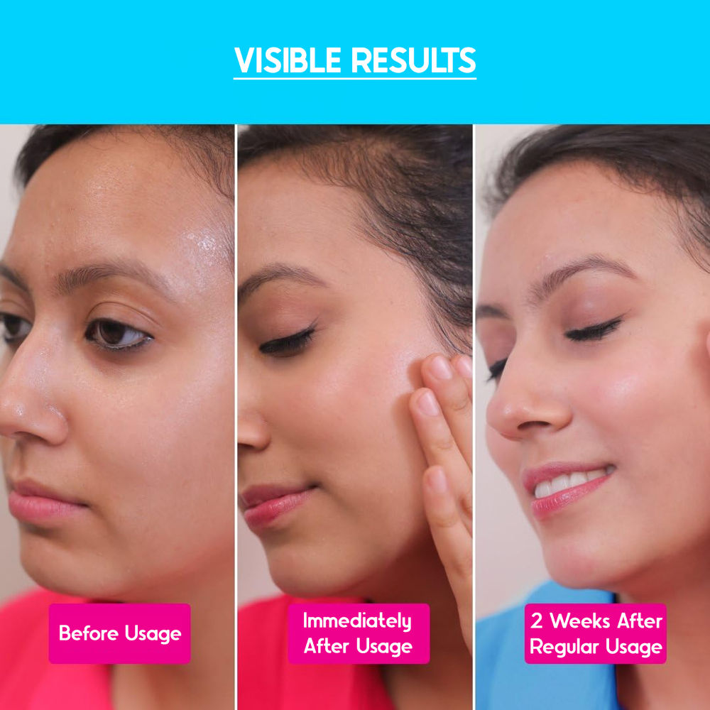 AirGel NMF 15% Moisturizer For Dry To Normal Skin
