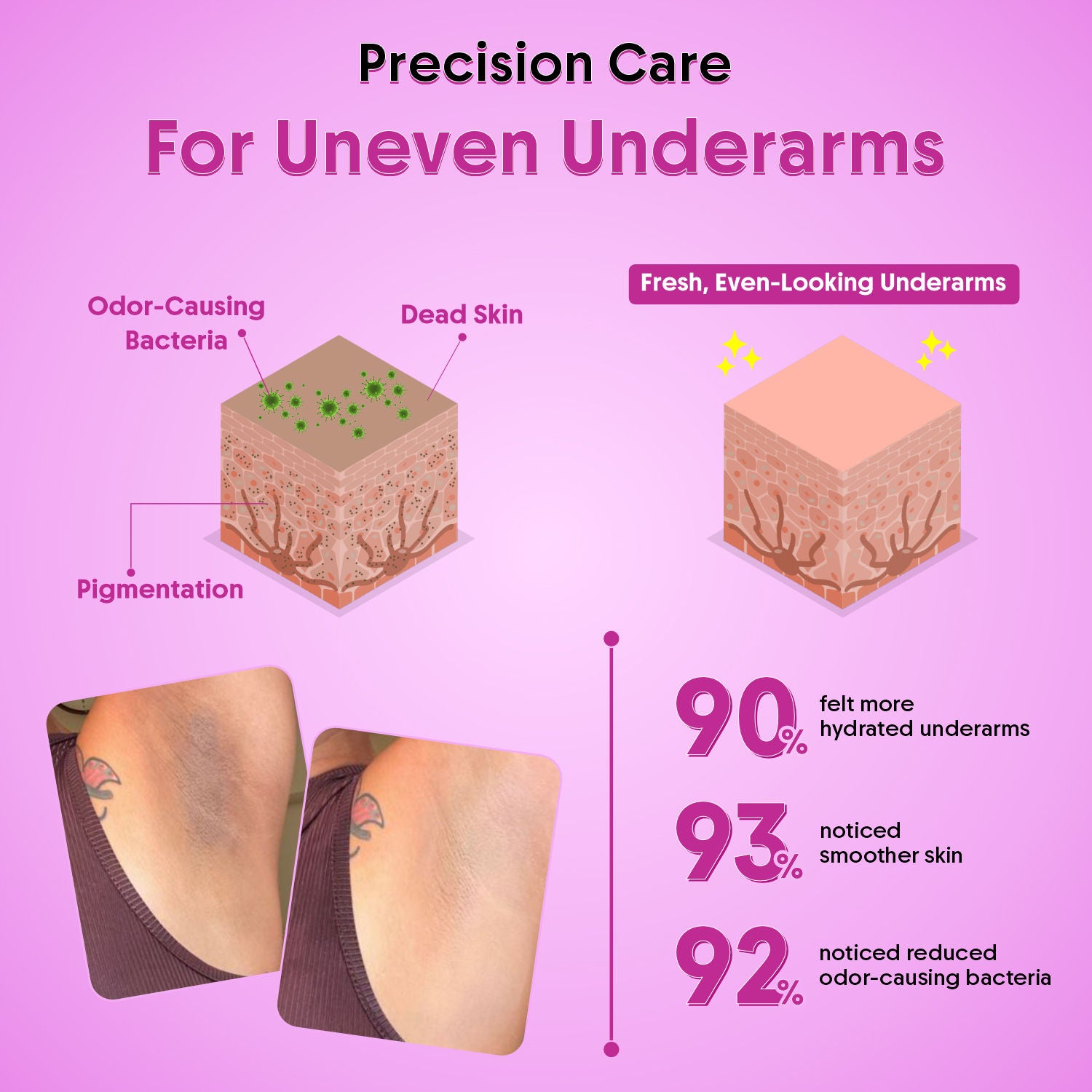 Whitening Underarm Roll On-5% AHA BHA + Kojic Acid For Dark Underarms & Odor Control
