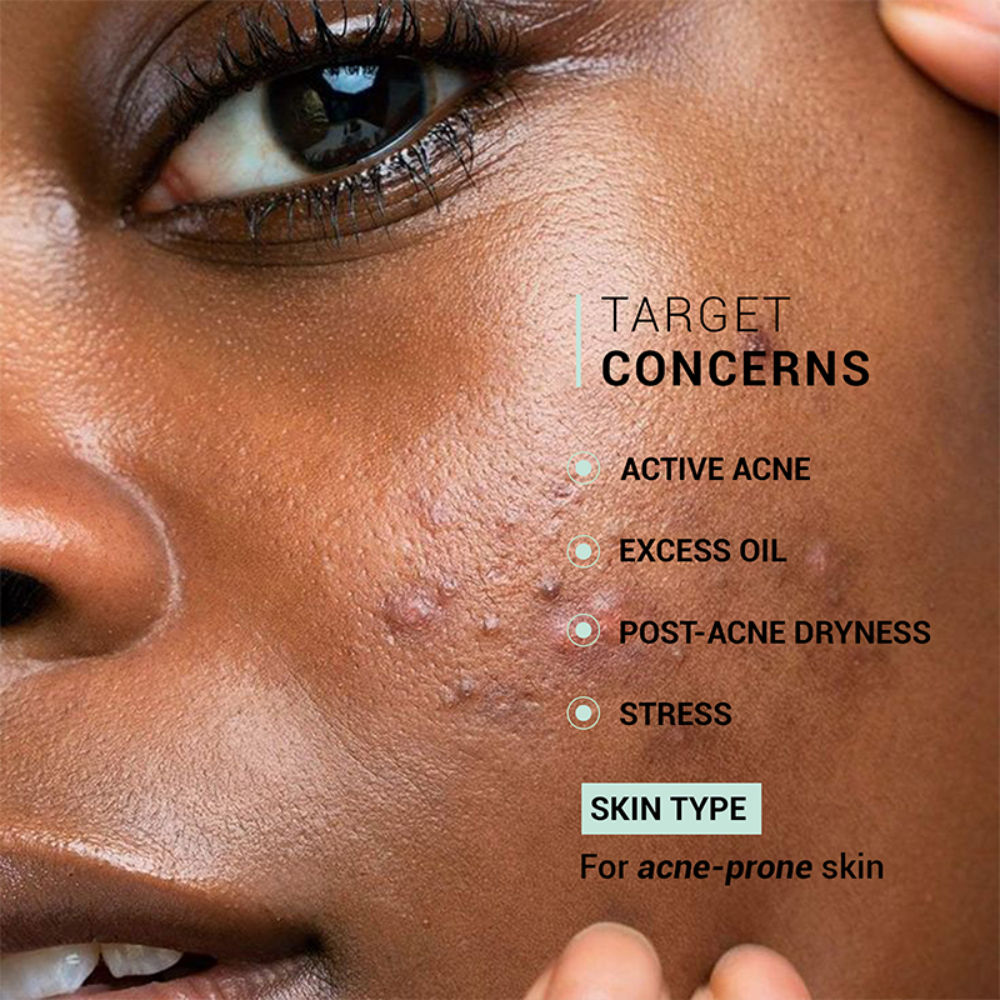 Oil Clear Face Moisturizer with Lactic Acid & NMF for Oily, Acne-Prone & Combination Skin