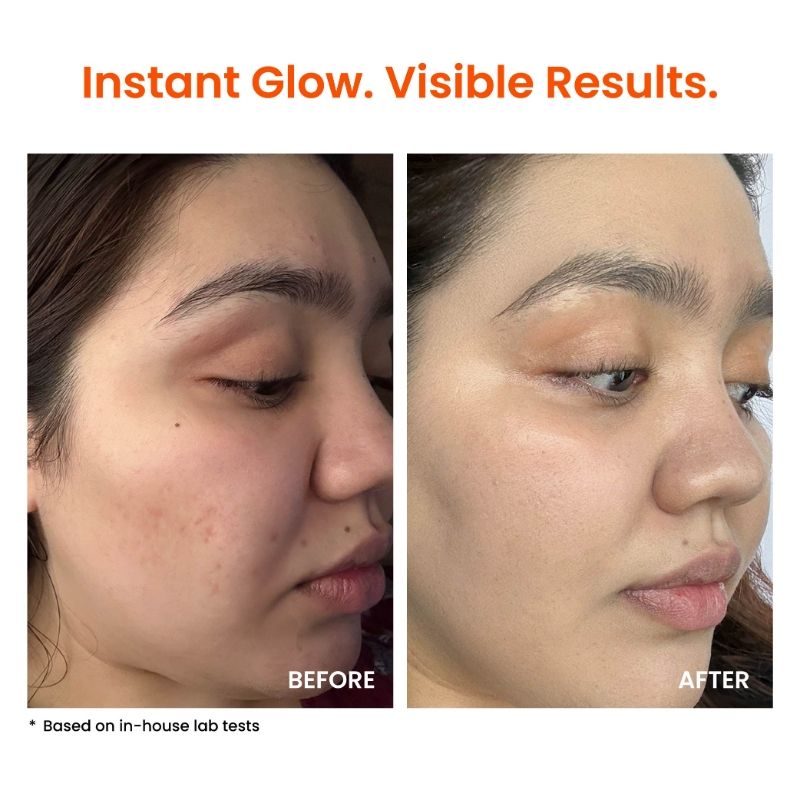 Super Glow Moisturizer with Vitamin C & Niacinamide For Dull, Pigmented & Uneven Skin