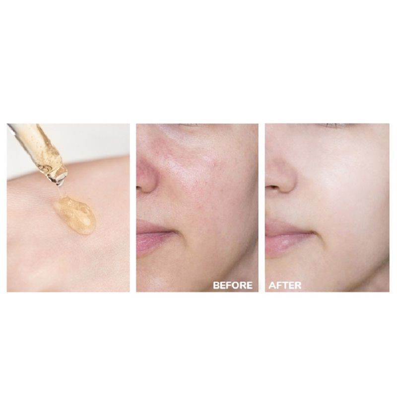 Vitamin C Brightening Lifting Face Serum With (3-O Ethyl Ascorbic Acid) For Brightening