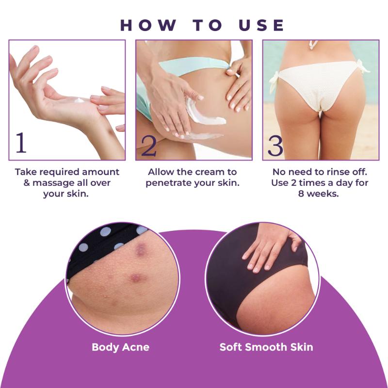 Back & Bum Cream For Dark Spots And Body Acne