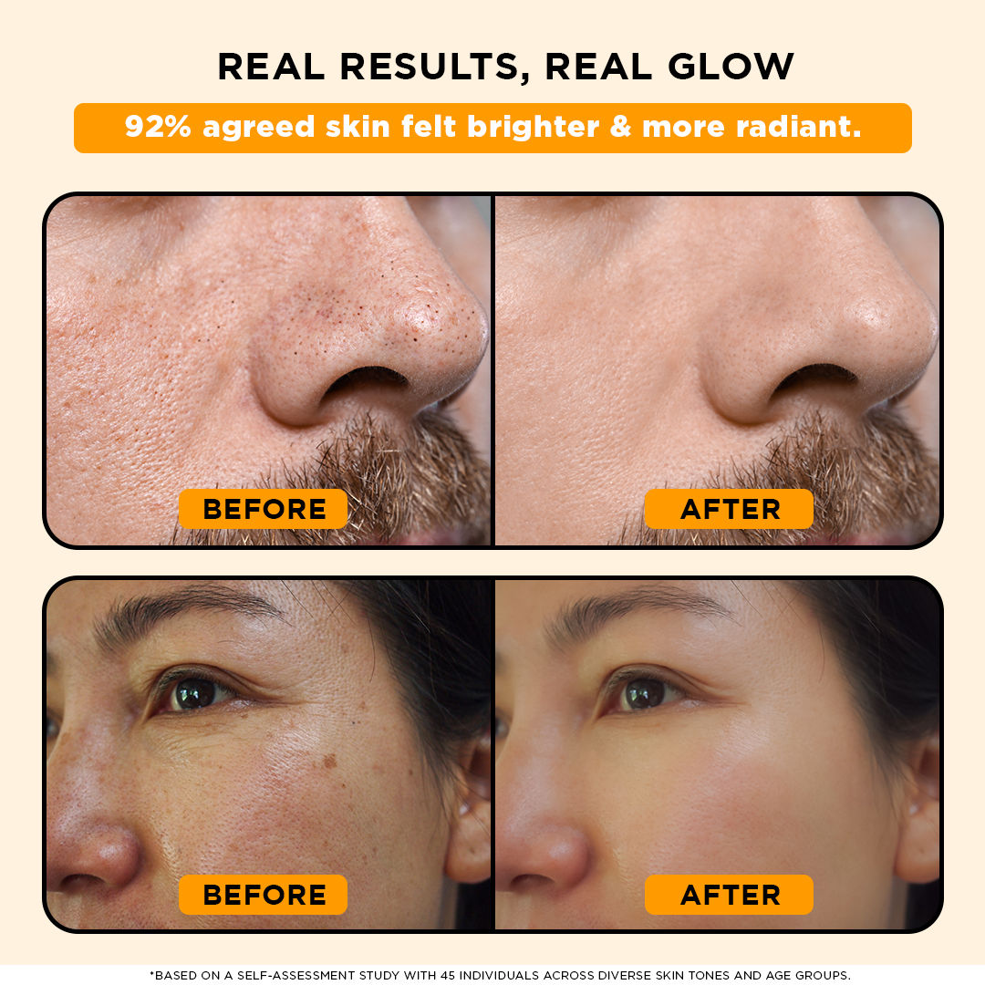 24K Gold Peel Off Mask For Glowing, Bright & Radiant Skin